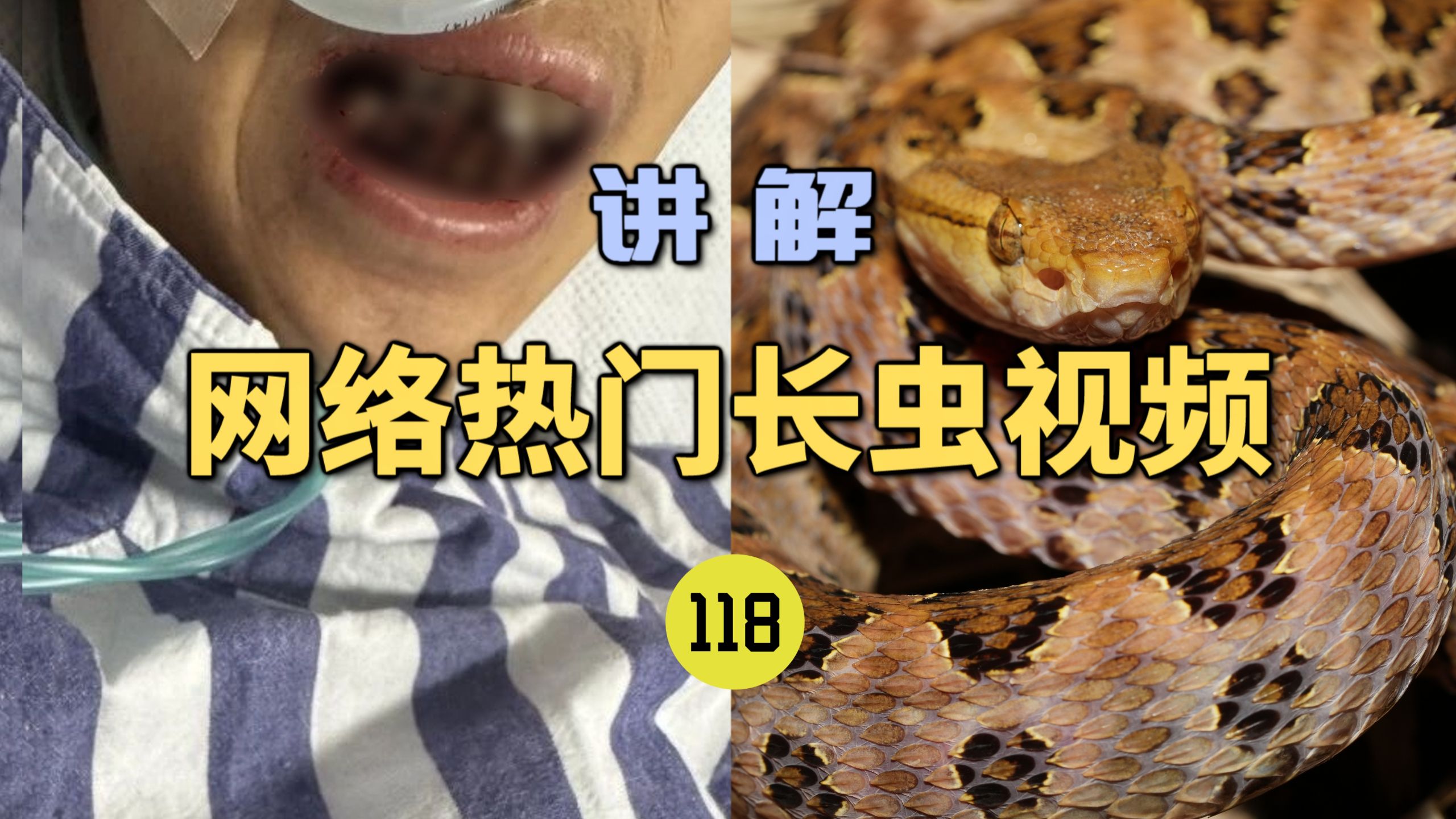 网络热门长虫视频(118)云南一女子被毒蛇咬伤后口吐鲜血!肇事毒蛇种类成谜?-世界记忆大师龙雅-世界记忆大师龙雅-哔哩哔哩视频