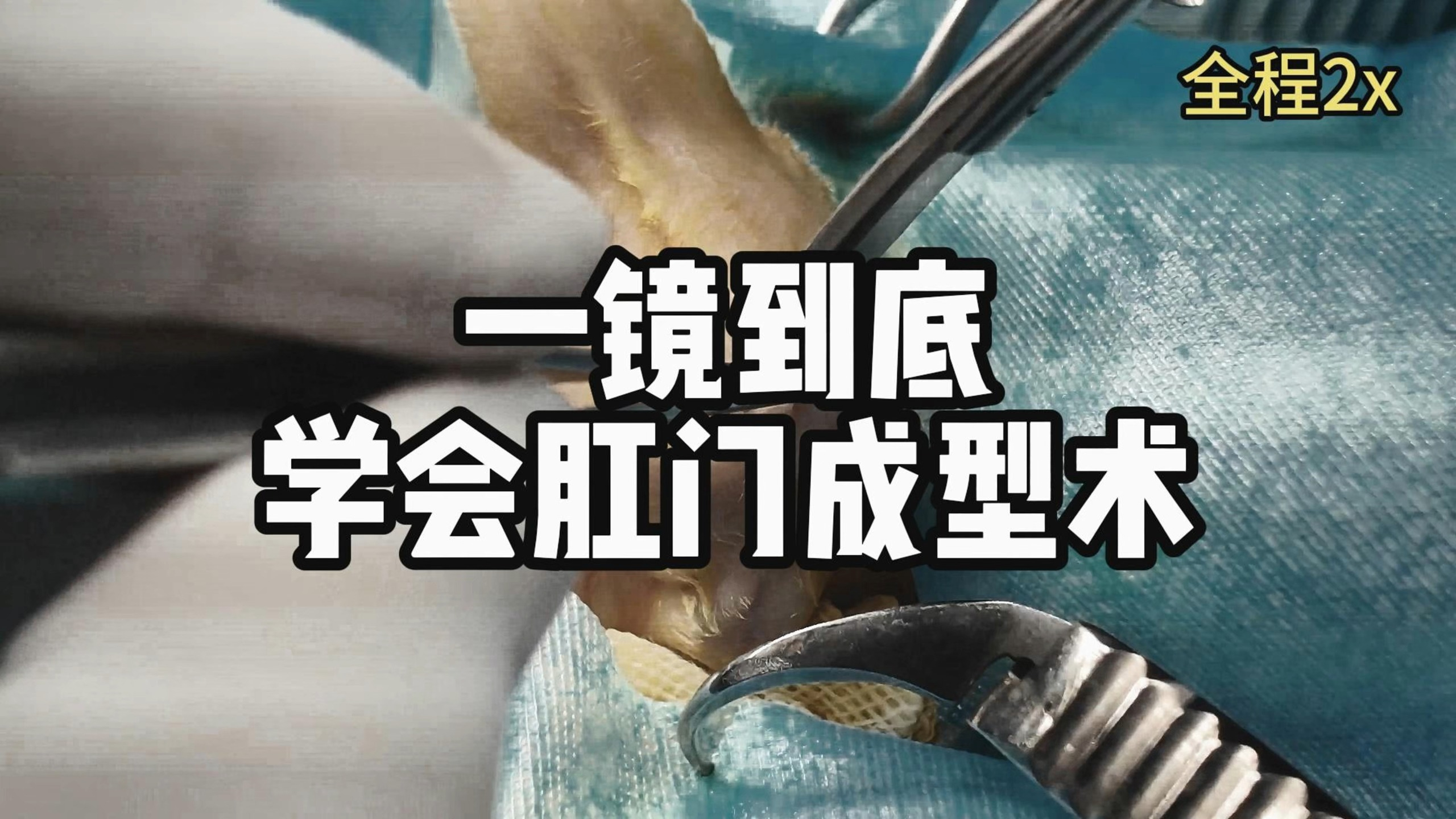 我在b站学兽医—肛门成形术
