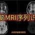 颅脑MRI基础：如何区分各序列MRI图像？医生讲解，初学者必看！