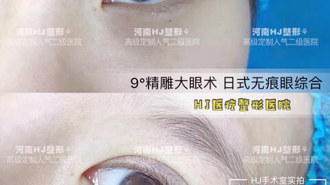 如何让眼睛更亮更美 ad705ff09825b6ade5a1922b4828c67353ab923e.jpg@480w_270h_1c