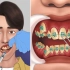 牙科医院 |牙齿正畸矫正全过程