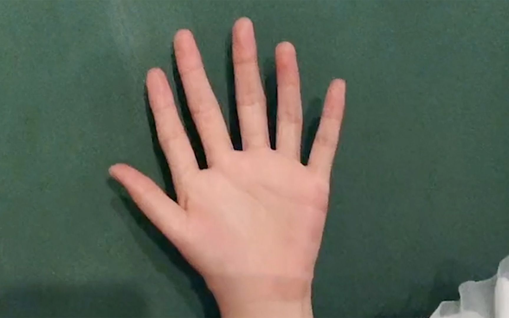 一只手有六个手指是种怎样的体验？ - 知乎