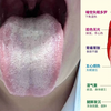 21岁小姑娘，夜晚手淫频繁，一点也不爱惜身体，神仙都难救