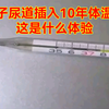 男子尿道插入10年体温计，这是什么体验