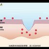 14-3 固有免疫应答的生物学作用