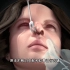 鼻整形手术过程，3D演示。。