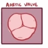 【搬运osmosis】Aortic valve disease (bicuspid, tricuspid)