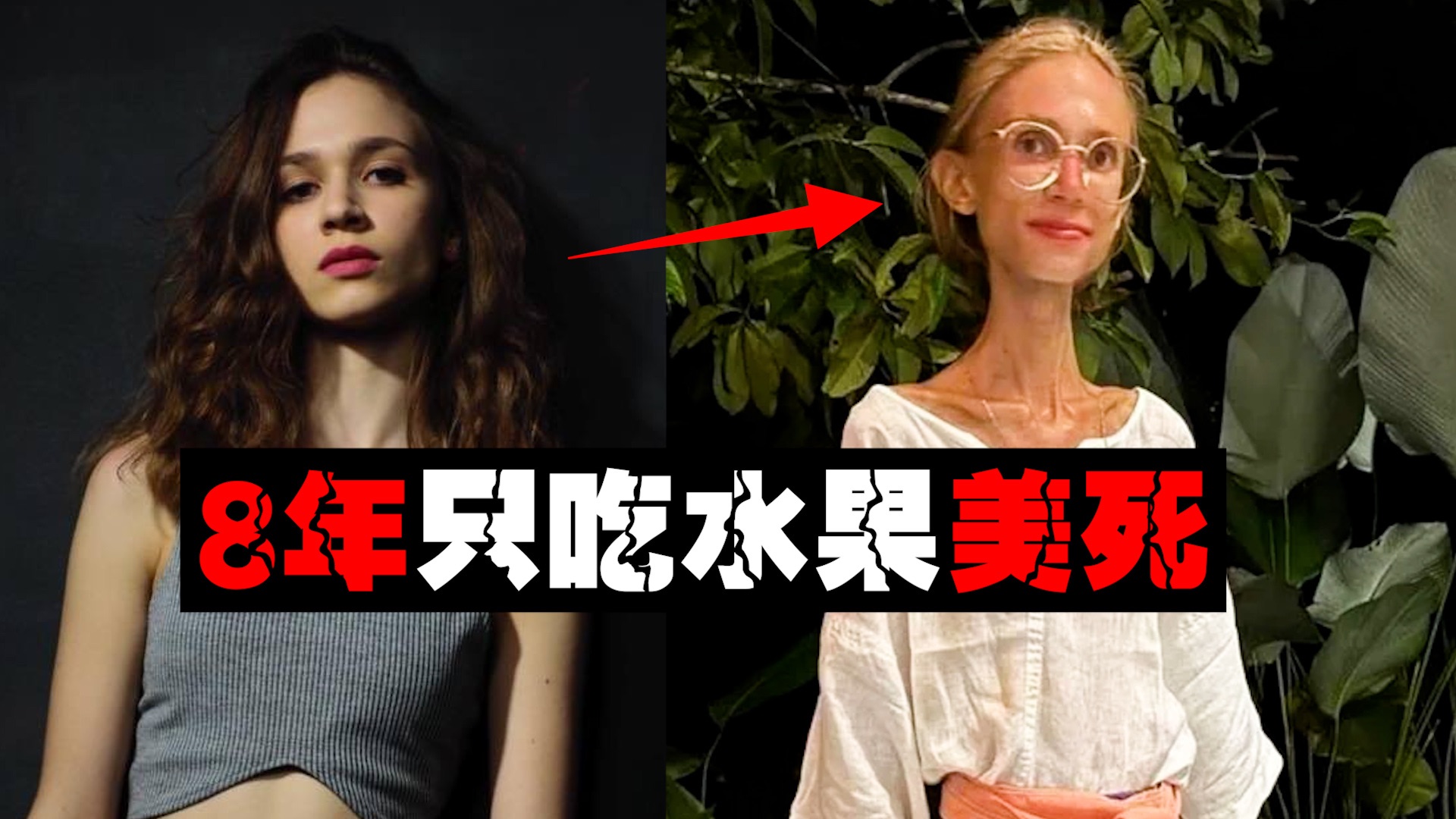 【水果主义】少女只吃水果瘦到22公斤被饿死，网友说她美极了。。。