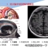放射医学技术知识点2-经大脑半球顶部的横断层