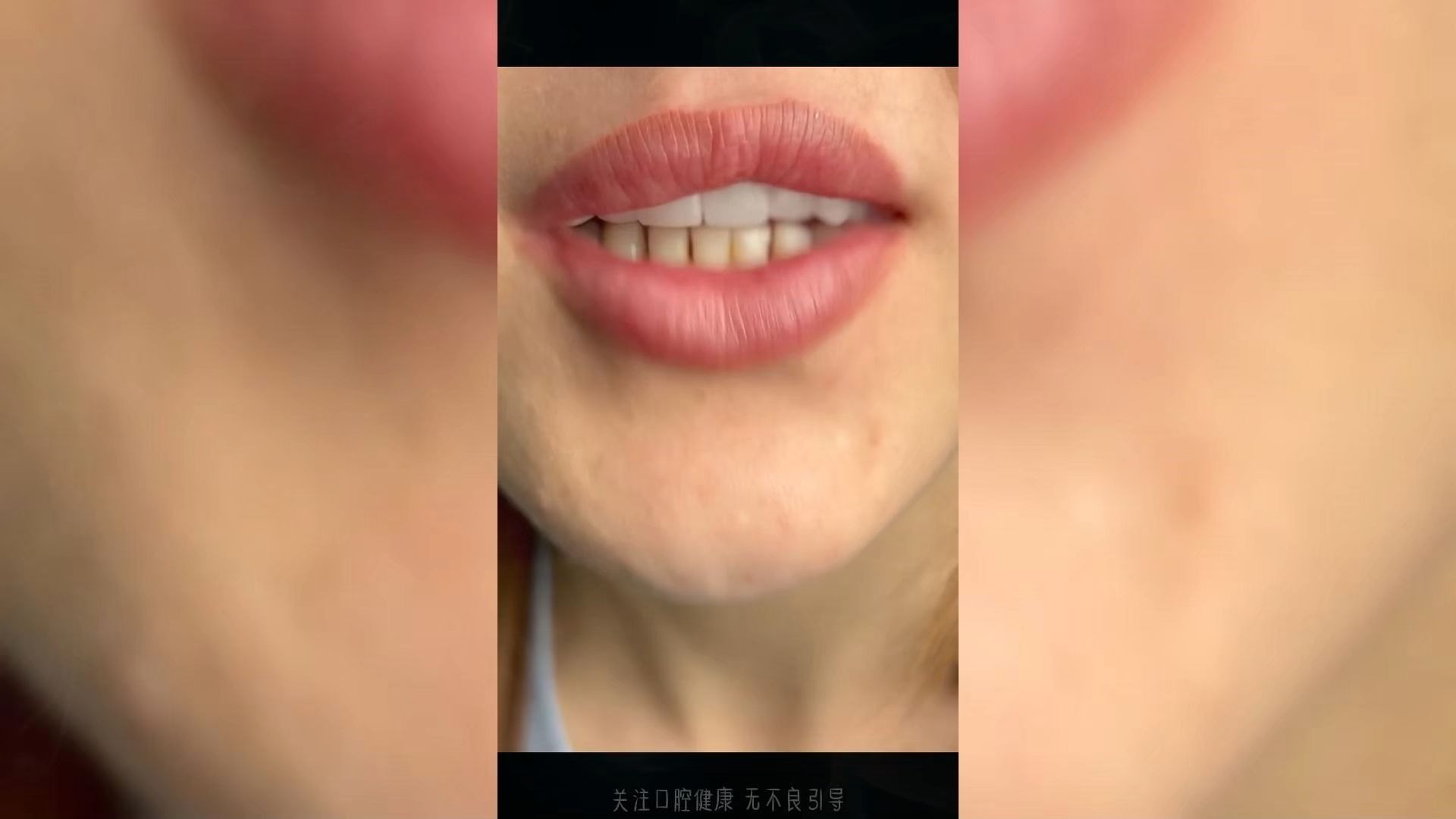 口腔健康观察