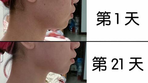 怎么瘦下巴和下颚线 b3684bf0c2880b194d8df6cb1929e47dd95fafb2.jpg@480w_270h_1c