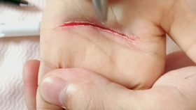 怎么画一条逼真的伤口 b5e0390878cdf21472fcc50646ea336d22f27aa0.jpg@280w_158h_1c_100q.jpg