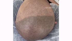 如何睡觉不会伤到头发 b61900355b1d1f6477ae6fe6fb90a6cb12f16386.jpg@280w_158h_1c_100q.jpg