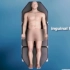 3D视频：腹股沟疝气手术