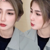 这ICU你就看吧，一看一个IVL