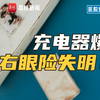 惊险！男子睡觉时充电器爆炸险失明