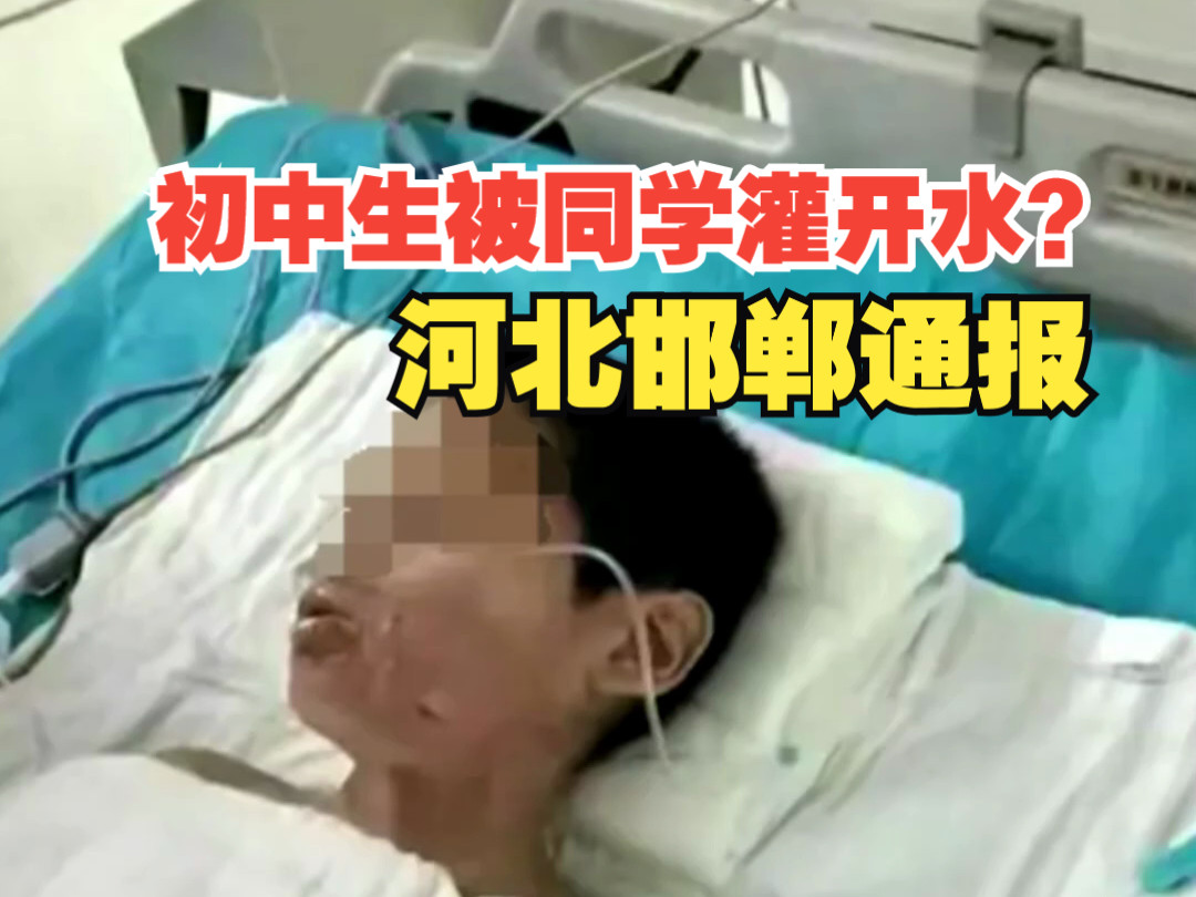 河北邯郸通报“初中生被同学灌开水”：面部胸部轻度烫伤，已治愈出院