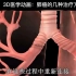 3D医学动画：肺癌的几种治疗方法