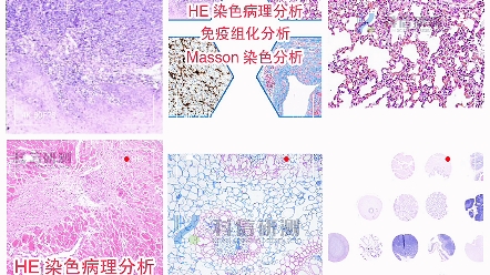 常见病理染色实验：HE染色，Masson染色，免疫组化免疫荧光，TUNEL 染色，PAS染色都可做，有需要的老师可点一点我~