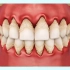 长期不好好刷牙，牙龈红肿萎缩，口臭，牙齿松动等问题接踵而来，你还不认真刷牙吗？