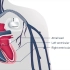 医学动画 - 心脏再同步化治疗（CRT）