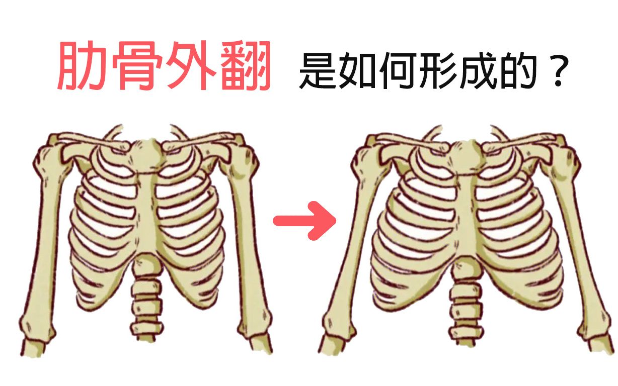 肋骨外翻是如何形成的?不同原因对应不同的解决方法!哔哩哔哩bilibili