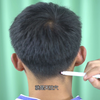 每日一穴——天柱穴