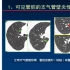 肺内病变CT诊断基础（柳澄）：03精准判读支气管感染的CT表现1