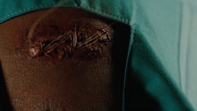 受伤缝针视频真实 bf3998efafdecdb8c5ce360a0cfe35ecee66ba77.jpg@280w_158h_1c_100q.jpg