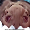 近亲结婚有多可怕？生下的孩子又畸形又痴呆，为何近亲结婚这么多