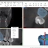 口腔种植体有限元分析（1）mimics三维模型重建：CT、MRI文件的导入及3D模型的提取、灰度值设定等