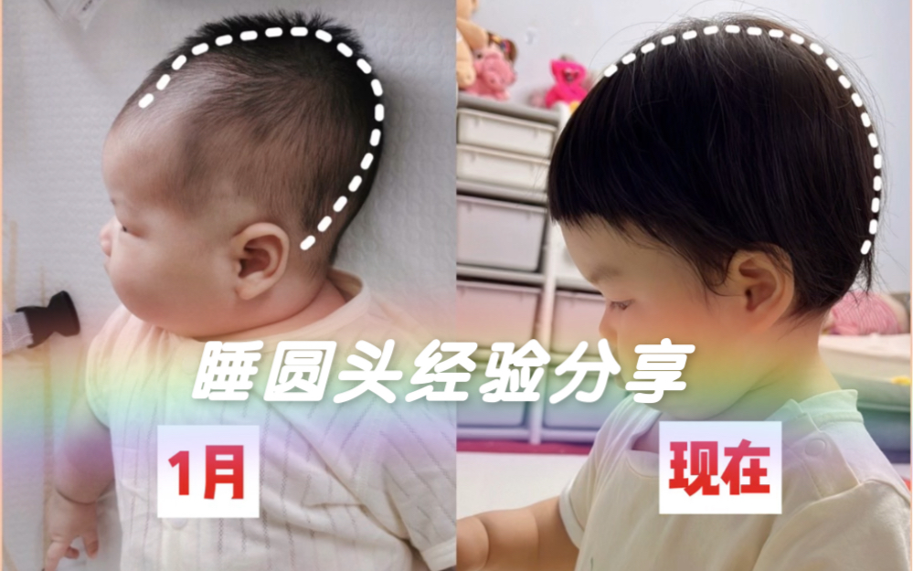 替孩子存下吧！超详细睡头型攻略！越早越好！