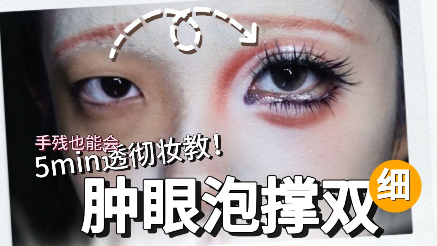 【肿眼泡撑双】5min讲透双眼皮的震撼强力支撑法