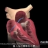 心脏射频消融术，3D演示。。