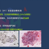 临床医学检验技术公开课：阴道分泌物检查三|山河医学网