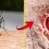 蚊子进入你身体吸血，放大后是这样的！视觉冲击