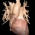 医学3D动画演示：冠状动脉粥样硬化是如何形成的？