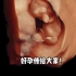 杭州玛莉亚妇产：胎儿在妈妈肚子里的个人独舞