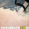 洗纹身到底能不能做到无痛不留疤