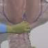【CVC】中心静脉穿刺置管｜模拟动画｜颈内静脉