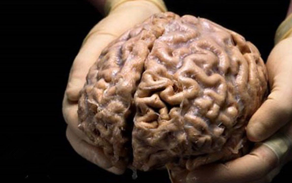 【脑洞大开】科学家成功培育"人工大脑",可弥补人脑缺陷,永生或成现实