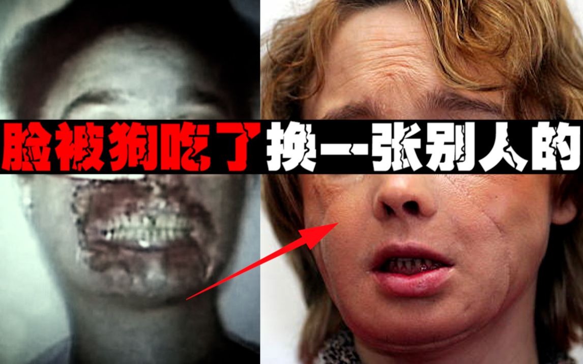 【换脸悲剧】换了一张别人的脸，生活开始倒计时