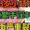 23岁小姑娘，性欲太强了，频繁手淫3年，舌面严重裂纹