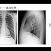 影像图片对比度本质