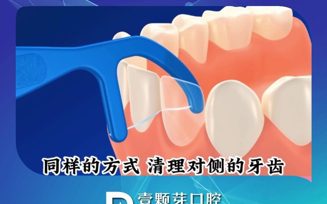 小牙线大作用，牙线能够有效清洁，牙齿邻面的细菌和残留物，保持牙齿以及牙龈健康，饮食后要及时漱口和用牙线清洁哦#口腔科普#烟台壹颗芽口腔