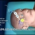 【中文字幕】原来麻醉医生靠这个一眼看出麻醉深度之-BIS监测仪器动画