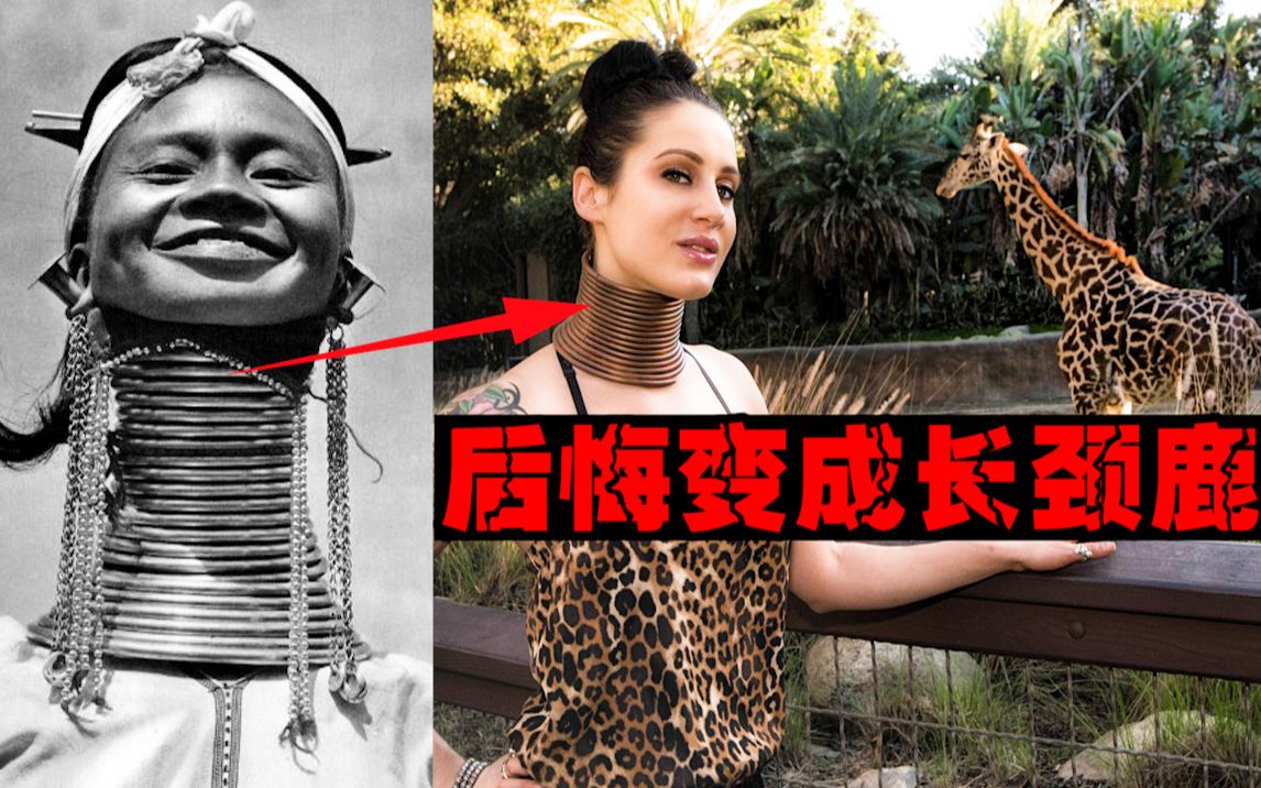 【长颈鹿女】花5年把自己变成长颈鹿，后悔无穷