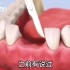 3D还原种植牙全过程，看着都酸爽