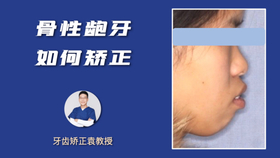 如何辨别自己是不是龅牙 d562eaba0de79ac78793f7f998c3b6ec0194df0a.jpg@280w_158h_1c_100q.jpg