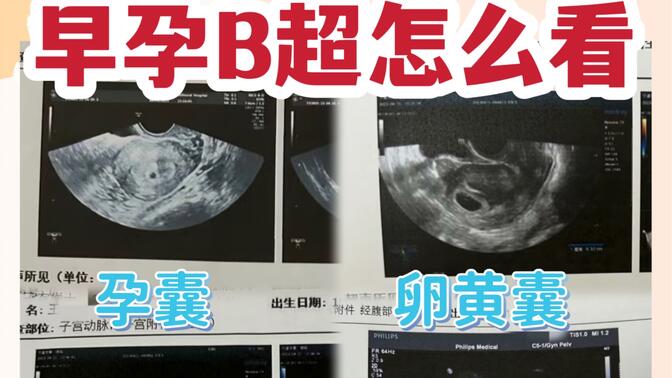 孕早期B超单怎么看？怎么推算孕周？孕囊、卵黄囊、胎心胎芽、头臀径……